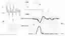Fig. 01 - Method for estimating an instantaneous pressure value in a fuel line of a fuel injection system