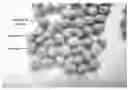 Fig. 01 - Methods and compositions for obtaining marker-free transgenic plants