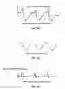 Fig. 05 - Method and apparatus of using peak force tapping mode to measure physical properties of a sample