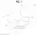 Fig. 02 - Ear protection device