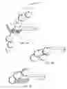 Fig. 02 - Hair clipper attachment guide