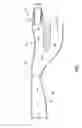 Fig. 02 - INLET PARTICLE SEPARATOR SYSTEM