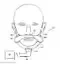 Fig. 01 - Patient interface assembly with conduits on each side of the head