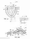 Fig. 35 - Methods and systems for improving airway patency