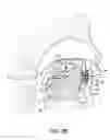 Fig. 04 - Methods and systems for saliva management with an oral device