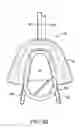 Fig. 06 - Methods and systems for saliva management with an oral device