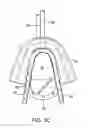 Fig. 07 - Methods and systems for saliva management with an oral device