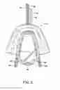 Fig. 09 - Methods and systems for saliva management with an oral device