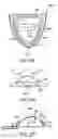 Fig. 28 - Methods and systems for saliva management with an oral device