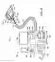 Fig. 40 - Methods and systems for saliva management with an oral device