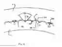 Fig. 08 - Wheel spindle drive element