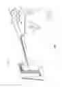 Fig. 02 - Surgical fastener