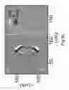 Fig. 09 - ION ACCELERATION METHOD, ION ACCELERATION APPARATUS, ION BEAM IRRADIATION APPARATUS, AND ION BEAM IRRADIATION APPARATUS FOR MEDICAL USE