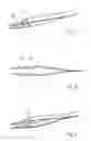 Fig. 02 - PRECISION TWEEZERS