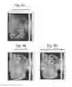 Fig. 05 - Method and system for processing mass analysis data