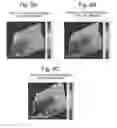 Fig. 08 - Method and system for processing mass analysis data