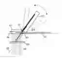Fig. 01 - APPARATUS FOR POSITIONING A PERCUTANEOUS ACCESS DEVICE