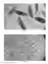 Fig. 13 - Compact, high-resolution fluorescence and brightfield microscope and methods of use