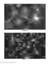 Fig. 15 - Compact, high-resolution fluorescence and brightfield microscope and methods of use