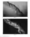 Fig. 17 - Compact, high-resolution fluorescence and brightfield microscope and methods of use