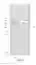 Fig. 15 - Liquid crystal display panel with unit pixels having slits in pixel electrode and photo alignment layers