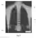 Fig. 06 - Devices and methods related to radiation delivery
