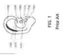 Fig. 02 - Methods and apparatuses for sound production