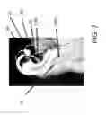 Fig. 07 - Methods and apparatuses for sound production