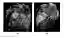 Fig. 01 - Method and system for heart isolation in cardiac computed tomography volumes for patients with coronary artery bypasses