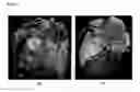 Fig. 02 - Method and system for heart isolation in cardiac computed tomography volumes for patients with coronary artery bypasses