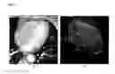 Fig. 09 - Method and system for heart isolation in cardiac computed tomography volumes for patients with coronary artery bypasses