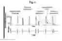 Fig. 02 - High throughput, optical method and system for determining the effect of a test substance on non-contiguous living cells