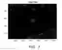 Fig. 04 - System and method for image registration based on variable region of interest