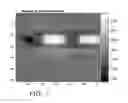 Fig. 07 - System and method for image registration based on variable region of interest