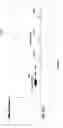 Fig. 02 - Continuously towed seafloor electromagnetic prospecting system