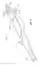 Fig. 15 - REPLACEABLE TIP FOR A BIT OR AUGER BIT