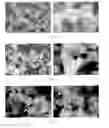 Fig. 02 - Ion substituted calcium phosphate particles