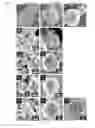 Fig. 07 - Ion substituted calcium phosphate particles