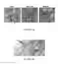 Fig. 05 - A3 adenosine receptor ligands for modulation of pigmentation