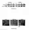 Fig. 09 - A3 adenosine receptor ligands for modulation of pigmentation