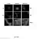 Fig. 11 - A3 adenosine receptor ligands for modulation of pigmentation