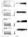 Fig. 06 - GLYCOSYLATED HUMAN ALPHA INTERFERON MUTEINS, METHOD FOR OBTAINING THEM AND USE