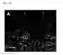 Fig. 02 - Method for differentiation of stem cells into vascular cells and the induction of angiogenesis using the same