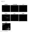 Fig. 05 - Method for differentiation of stem cells into vascular cells and the induction of angiogenesis using the same