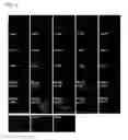 Fig. 06 - Method for differentiation of stem cells into vascular cells and the induction of angiogenesis using the same