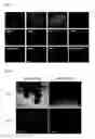 Fig. 07 - Method for differentiation of stem cells into vascular cells and the induction of angiogenesis using the same