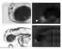 Fig. 01 - PHARMACEUTICAL COMPOSITION CONTAINING NUCLEAR FACTOR INVOLVED IN PROLIFERATION AND DIFFERENTIATION OF CENTRAL NEURONAL CELLS