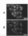 Fig. 01 - Methods and compositions for targeting polyubiquitin