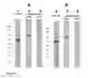 Fig. 09 - Method for the purification of protein complexes