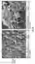 Fig. 07 - Corticosteroid particles and method of production